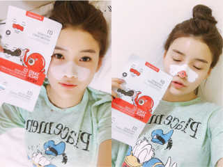나이팅게일 TAKO PACK NOSE [문어코팩] — 3.5점을 준 리뷰어가 2017년 1월 올린 사용 사진