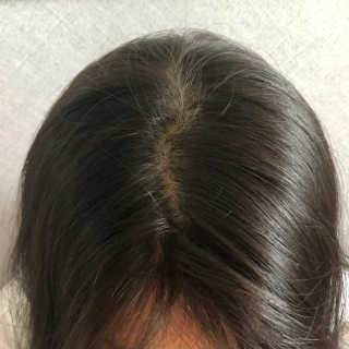 (주)에네스티 미스랩 더블 클리닉 헤어 컬러 크림 — 4.5점을 준 리뷰어가 2019년 8월 올린 사용 사진
