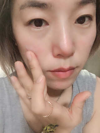 스케덤 클루덤 메디 에프터 크림 — 5점을 준 리뷰어가 2019년 1월 올린 사용 사진