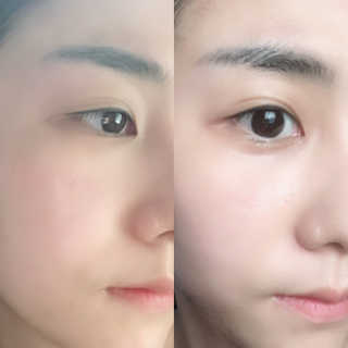 키노닉스 Querencia_Flawless 마스크팩 — 5점을 준 리뷰어가 2019년 3월 올린 사용 사진