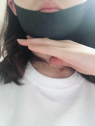 어웨이크어슬립 어슬립 페이스 리프트업 밴드 — 5점을 준 리뷰어가 2018년 6월 올린 사용 사진