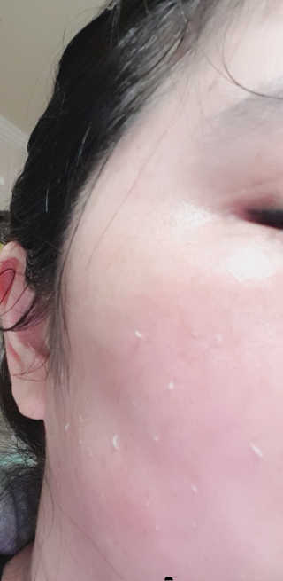 타임인네이처 [더메디닥터] 카렌듈라 엔자임 필링젤 — 4점을 준 리뷰어가 2019년 3월 올린 사용 사진