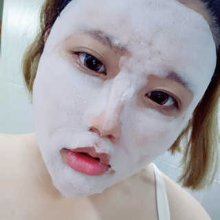 셀퓨전씨 트리악 포어 딜리트 버블 팩 — 5점을 준 리뷰어가 2018년 7월 올린 사용 사진