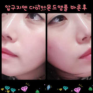 닥터웰메이드원 압구지엔 다이아몬드 링거앰플 — 5점을 준 리뷰어가 2018년 12월 올린 사용 사진