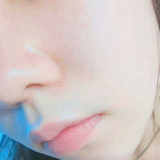 시카고 시카 더블 이펙트 앰플 30ml 기획세트 — 5점을 준 리뷰어가 2018년 8월 올린 사용 사진