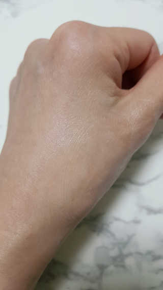 리얼베리어 시카릴리프 젤 밤 — 5점을 준 리뷰어가 2019년 3월 올린 사용 사진
