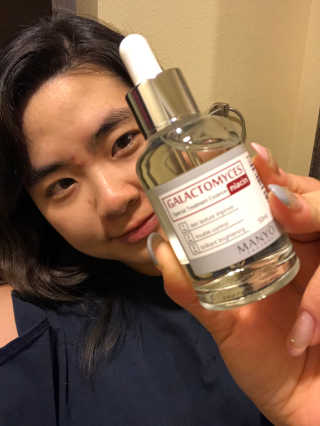 [마녀 공장] 발가락 토미 니아신 에센스 50ml — 5점을 준 리뷰어가 2018년 11월 올린 사용 사진