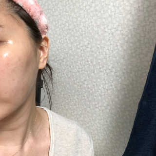 닥터웰메이드원 압구지엔 다이아몬드 링거앰플 — 4점을 준 리뷰어가 2019년 2월 올린 사용 사진