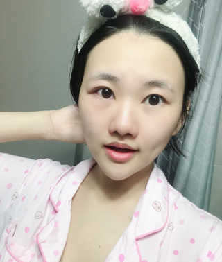 닥터플로라 천연 애플버블 클렌징폼 — 4점을 준 리뷰어가 2018년 7월 올린 사용 사진