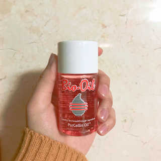 Bio-oil(바이오오일) 바이오오일(Bio-oil) — 3점을 준 리뷰어가 2017년 2월 올린 사용 사진
