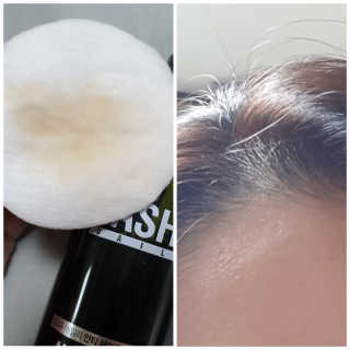 다슈코리아 다슈 데일리 안티 헤어로스 허브 헤어토닉 150ml — 3점을 준 리뷰어가 2019년 10월 올린 사용 사진