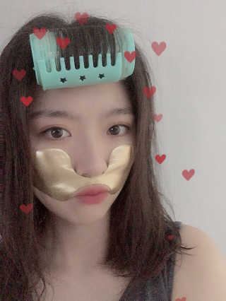 [스케덤] 상악밴드 — 5점을 준 리뷰어가 2019년 7월 올린 사용 사진