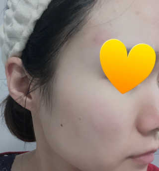 바디버든프로젝트 바디버든 프로젝트 BBP 시카 토너패드 — 4.5점을 준 리뷰어가 2019년 7월 올린 사용 사진