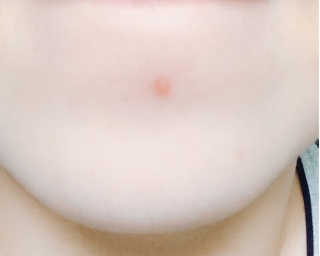 라포랩 laforlab 라포랩 센텔라스카 연고(바질) — 5점을 준 리뷰어가 2017년 12월 올린 사용 사진