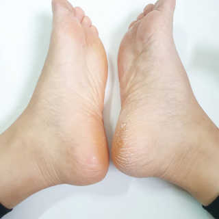 superjjonga님이 올린 리뷰 사진 2