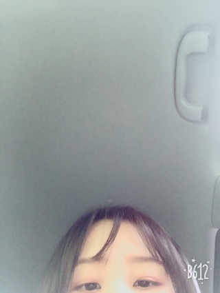 다슈코리아 다슈 데일리 탈모완화 초강력 헤어 스프레이 — 2.83점을 준 리뷰어가 2018년 5월 올린 사용 사진