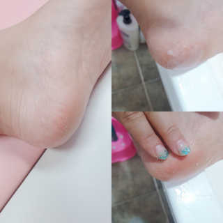 아미니 릴렉싱 풋 필링 스프레이 — 1점을 준 리뷰어가 2019년 8월 올린 사용 사진