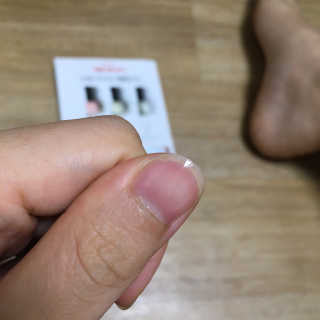 세트 하나로 손발톱 건강걱정 끝내는 위드샨 닥터3종 — 5점을 준 리뷰어가 2020년 1월 올린 사용 사진