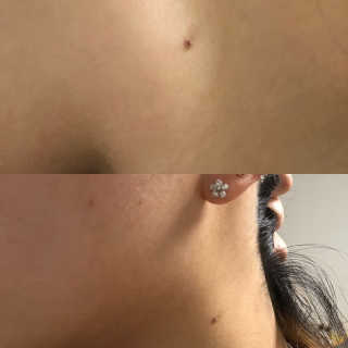 순이츠님이 올린 리뷰 사진 2