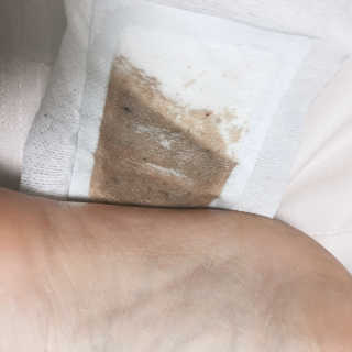 메디테라피 더마 릴렉스 힐링패치 — 4점을 준 리뷰어가 2018년 4월 올린 사용 사진