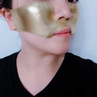 [스케덤] 상악밴드 — 4점을 준 리뷰어가 2019년 5월 올린 사용 사진
