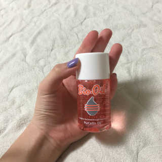 Bio-oil(바이오오일) 바이오오일 — 3.5점을 준 리뷰어가 2016년 10월 올린 사용 사진