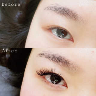 Viewty Skin and Lash [ViewtySkin＆Lash] 종아리 림프순환 부종관리 — 4.5점을 준 리뷰어가 2019년 3월 올린 사용 사진