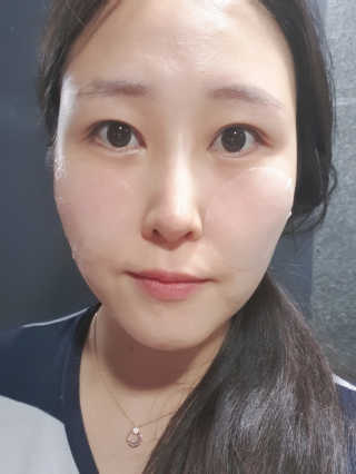 자이엘 S.O.S 레드 칙 케어팩 2 Box — 4점을 준 리뷰어가 2020년 3월 올린 사용 사진