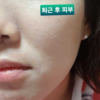 라임코스메틱 V 콜라겐 앰플 쿠션 — 5점을 준 리뷰어가 2020년 2월 올린 사용 사진