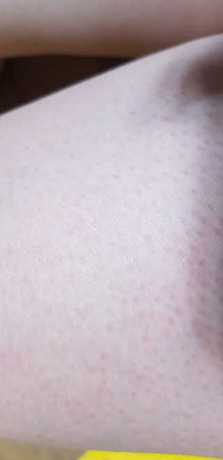 [크나이프] 그레이프씨드 슬리밍 마사지오일 100ml — 3.5점을 준 리뷰어가 2019년 8월 올린 사용 사진