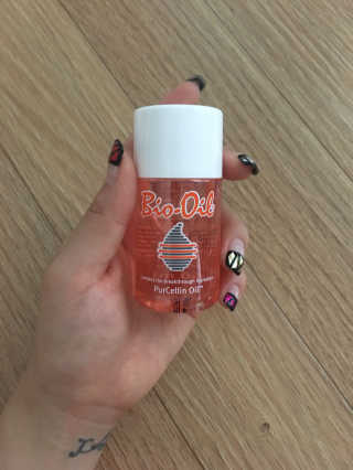 Bio-oil(바이오오일) 바이오오일 — 4점을 준 리뷰어가 2016년 9월 올린 사용 사진