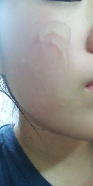 [후르디아] 모공케어 겉보속촉 여름 수분크림 — 5점을 준 리뷰어가 2019년 8월 올린 사용 사진