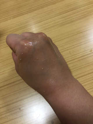 타임인네이처 [더메디닥터] 카렌듈라 엔자임 필링젤 — 2점을 준 리뷰어가 2019년 3월 올린 사용 사진