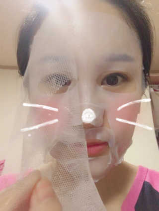 에슬레나 엑스트라 밸런싱 힐링 마스크 10장 — 4점을 준 리뷰어가 2017년 10월 올린 사용 사진