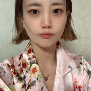 아이디플라코스메틱 아이디 페이스핏 마이너스 밴드 — 5점을 준 리뷰어가 2020년 1월 올린 사용 사진