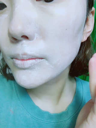 아크웰 아크네 클리어링 딥 클렌징 폼 — 3.5점을 준 리뷰어가 2019년 3월 올린 사용 사진