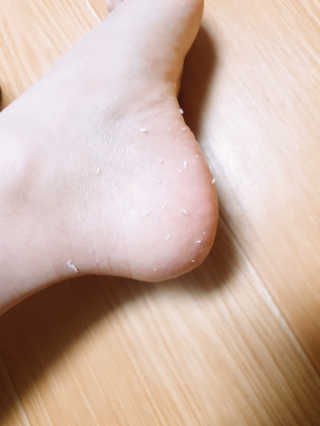 아미니 릴렉싱 풋 필링 스프레이 — 5점을 준 리뷰어가 2019년 4월 올린 사용 사진