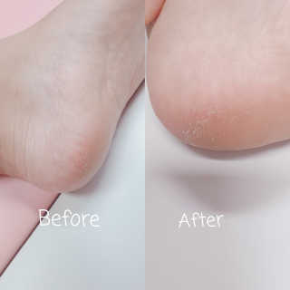 아미니 릴렉싱 풋 필링 스프레이 — 1점을 준 리뷰어가 2019년 8월 올린 사용 사진