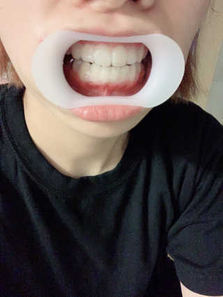 미서지롱님이 올린 리뷰 사진 4