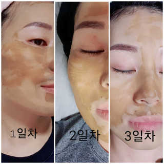플러스셀라 시카골드 클렌징바 화산재팩 세트 — 5점을 준 리뷰어가 2020년 1월 올린 사용 사진