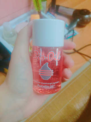 Bio-oil(바이오오일) 바이오오일 — 4.5점을 준 리뷰어가 2016년 10월 올린 사용 사진