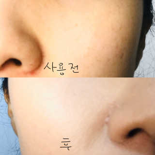 다슈코리아 다슈 맨즈 아쿠아 매트 쿠션 — 5점을 준 리뷰어가 2020년 1월 올린 사용 사진