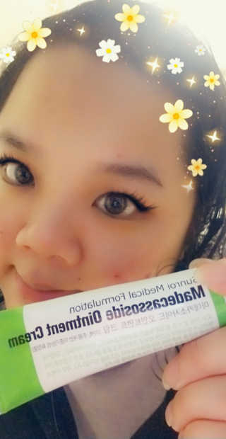 선로이 마데 카소 사이드 크림 50g 1.7Oz — 4점을 준 리뷰어가 2019년 5월 올린 사용 사진