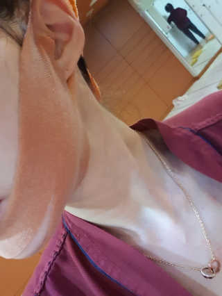 아이디플라코스메틱 아이디 페이스핏 마이너스 밴드 — 5점을 준 리뷰어가 2020년 1월 올린 사용 사진