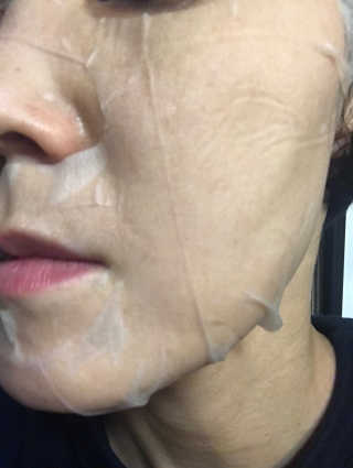 보타메디 씨놀®미라클마스크팩 — 4점을 준 리뷰어가 2018년 11월 올린 사용 사진