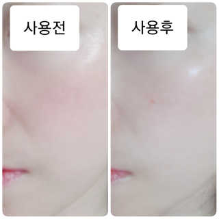 비알티씨 더 퍼스트 앰플 에센스 — 5점을 준 리뷰어가 2019년 4월 올린 사용 사진