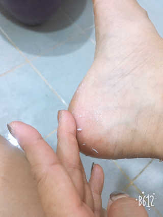 아미니 릴렉싱 풋 필링 스프레이 — 5점을 준 리뷰어가 2019년 8월 올린 사용 사진