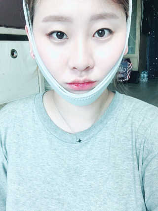 메디미 브이미 업 2스텝 브이라인벨트 — 4.5점을 준 리뷰어가 2017년 9월 올린 사용 사진