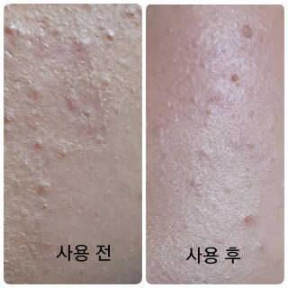 김상아님이 올린 리뷰 사진 4