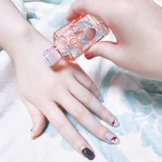 Bio-oil(바이오오일) 바이오오일(Bio-oil) — 5점을 준 리뷰어가 2016년 12월 올린 사용 사진